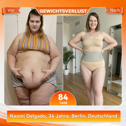 👙 Offizieller Brand Store | 🍑🍑 GFOUK® 2026 Moringa & Berberin 4-in-1 Mikropartikel-Sculpting- & Fettverbrennungs-Shorts