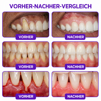Rolimey® VioCore Zahnpasta zur Behandlung von Zahnfleischentzündungen und Parodontitis mit Bienengift