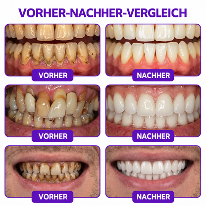 Rolimey® VioCore Zahnpasta zur Behandlung von Zahnfleischentzündungen und Parodontitis mit Bienengift