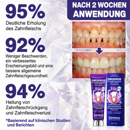 Rolimey® VioCore Zahnpasta zur Behandlung von Zahnfleischentzündungen und Parodontitis mit Bienengift