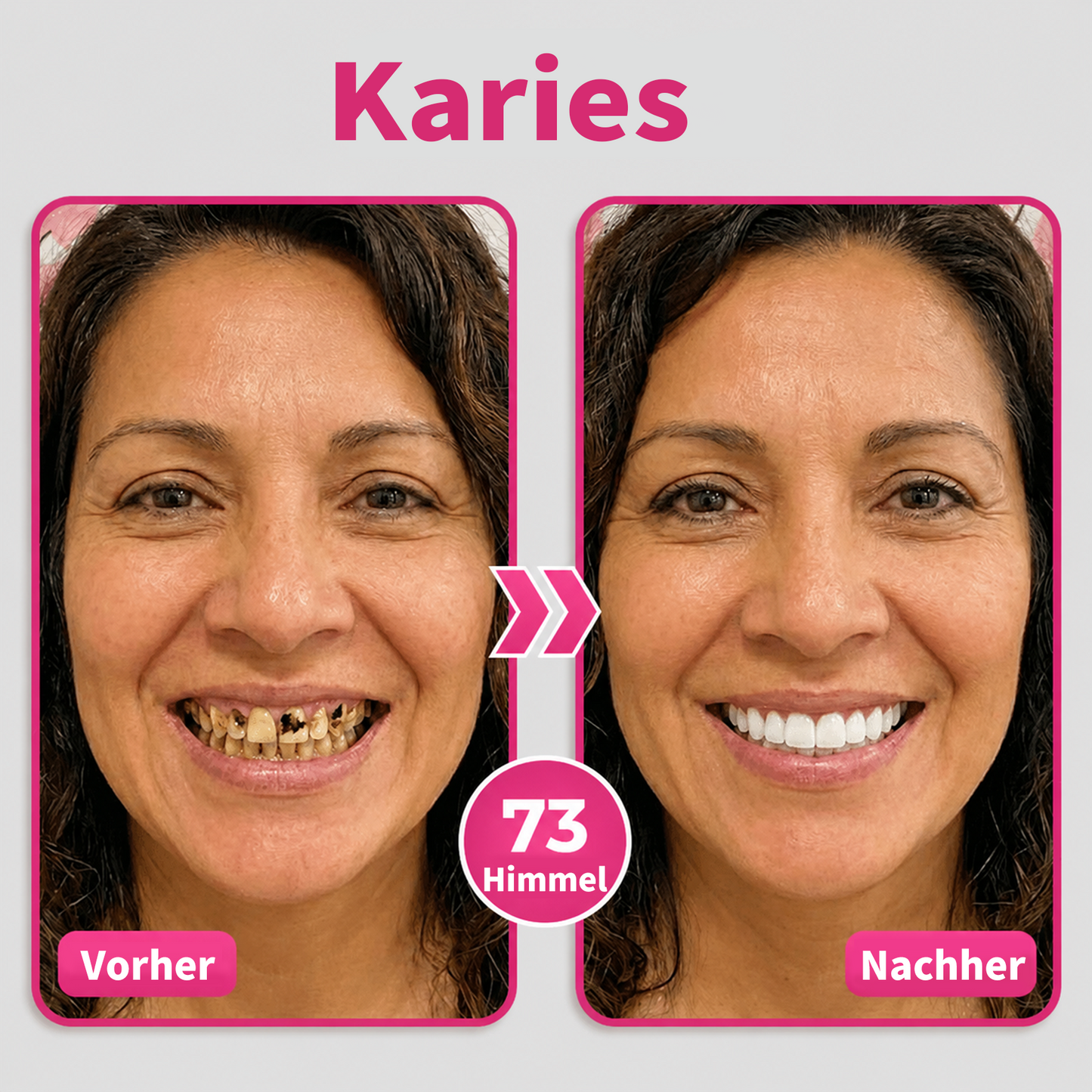 Genieße 30 % Rabatt beim Hinzufügen des zweiten Artikels ❤️‍🔥
