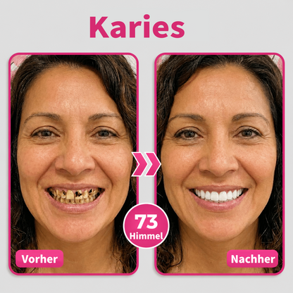 Genieße 30 % Rabatt beim Hinzufügen des zweiten Artikels ❤️‍🔥