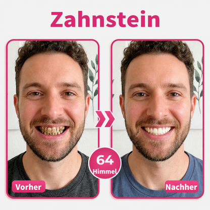Genieße 30 % Rabatt beim Hinzufügen des zweiten Artikels ❤️‍🔥