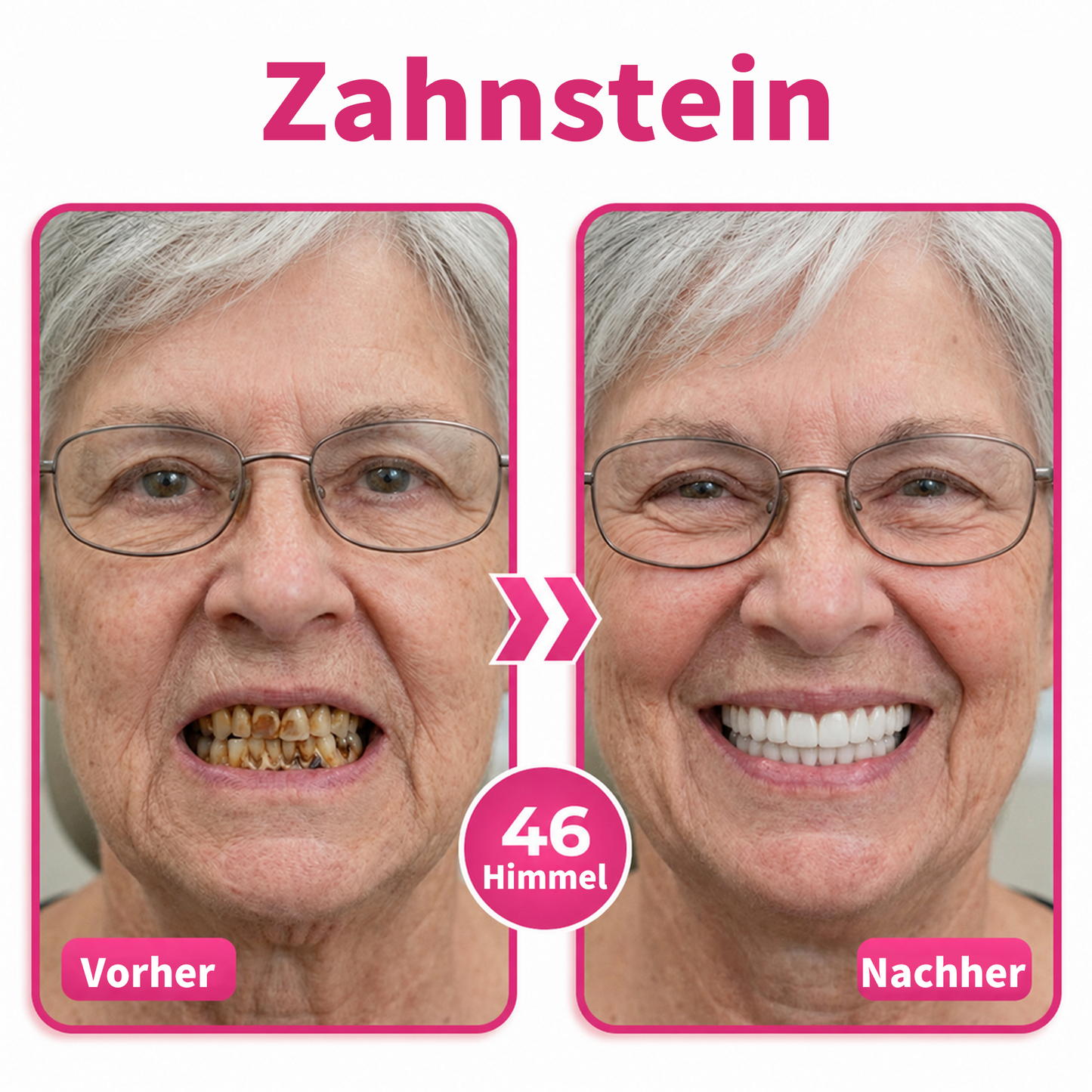 Genieße 30 % Rabatt beim Hinzufügen des zweiten Artikels ❤️‍🔥