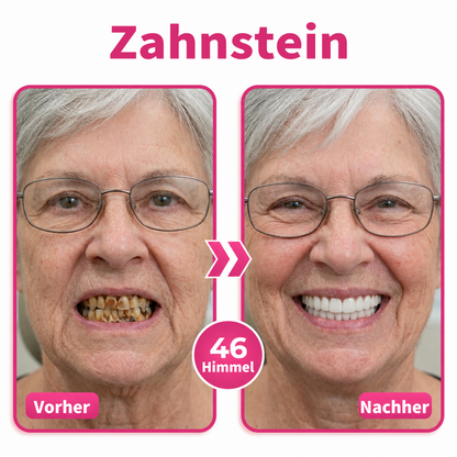 Genieße 30 % Rabatt beim Hinzufügen des zweiten Artikels ❤️‍🔥