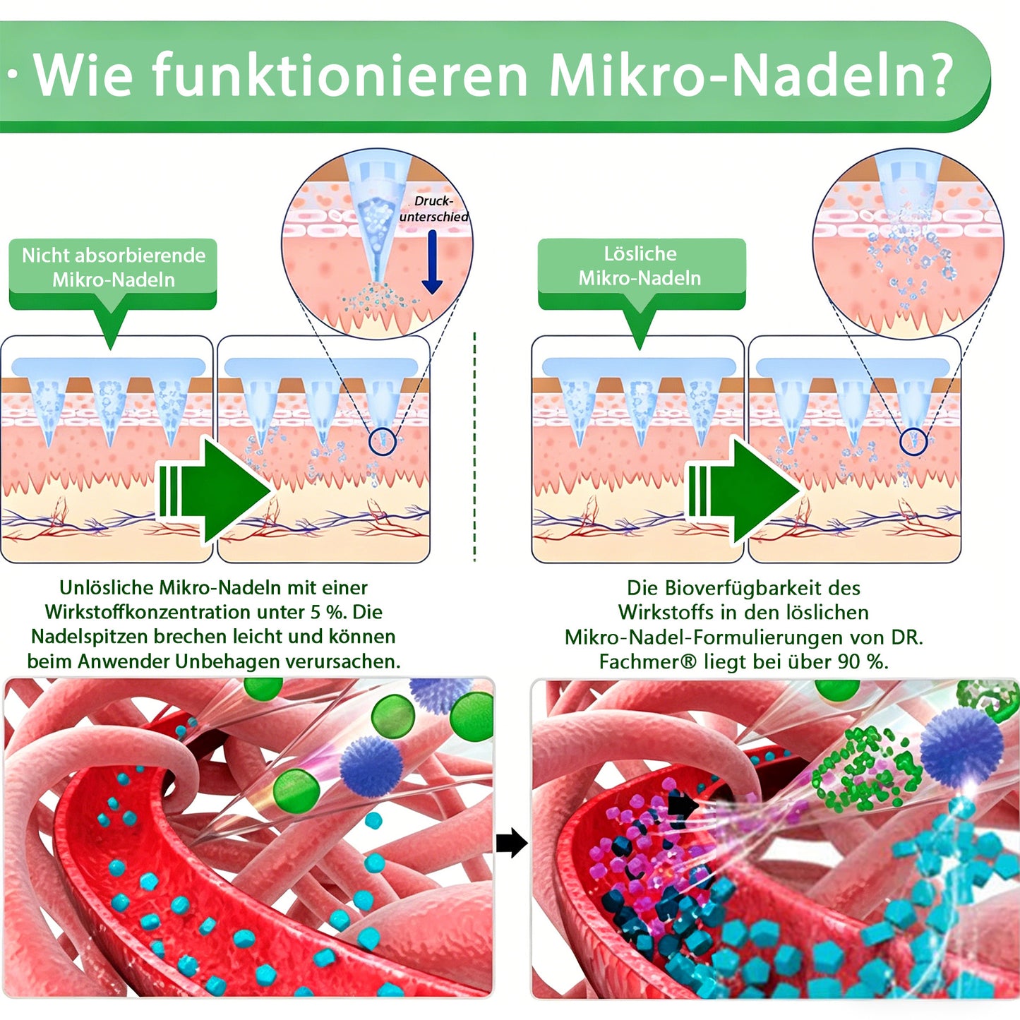 🇩🇪Offizieller Shop | 🏆 DR.Fachmer® Moringa Berberinex NAD+ 10-in-1 Nano-Mikronadel-Patch (Nur einmal täglich, sichtbare Veränderungen in 7 Tagen) ✅ Für Übergewicht, lockere Haut, Diabetes, Schlafapnoe, Gelenkprobleme und mehr