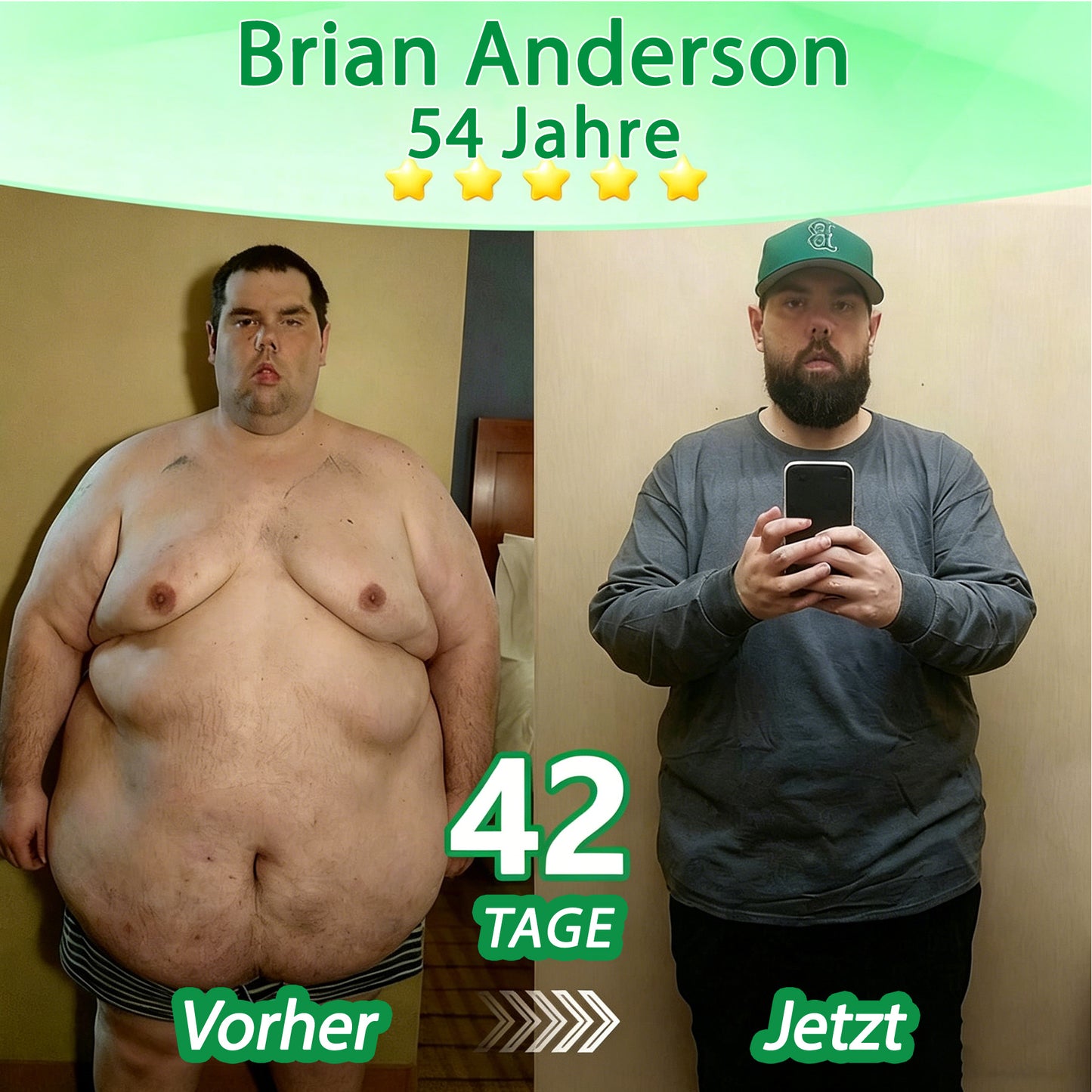 🇩🇪Offizieller Shop | 🏆 DR.Fachmer® Moringa Berberinex NAD+ 10-in-1 Nano-Mikronadel-Patch (Nur einmal täglich, sichtbare Veränderungen in 7 Tagen) ✅ Für Übergewicht, lockere Haut, Diabetes, Schlafapnoe, Gelenkprobleme und mehr