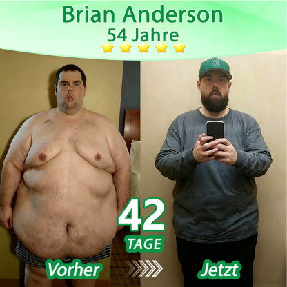 🇩🇪Offizieller Shop | 🏆 DR.Fachmer® Moringa Berberinex NAD+ 10-in-1 Nano-Mikronadel-Patch (Nur einmal täglich, sichtbare Veränderungen in 7 Tagen) ✅ Für Übergewicht, lockere Haut, Diabetes, Schlafapnoe, Gelenkprobleme und mehr
