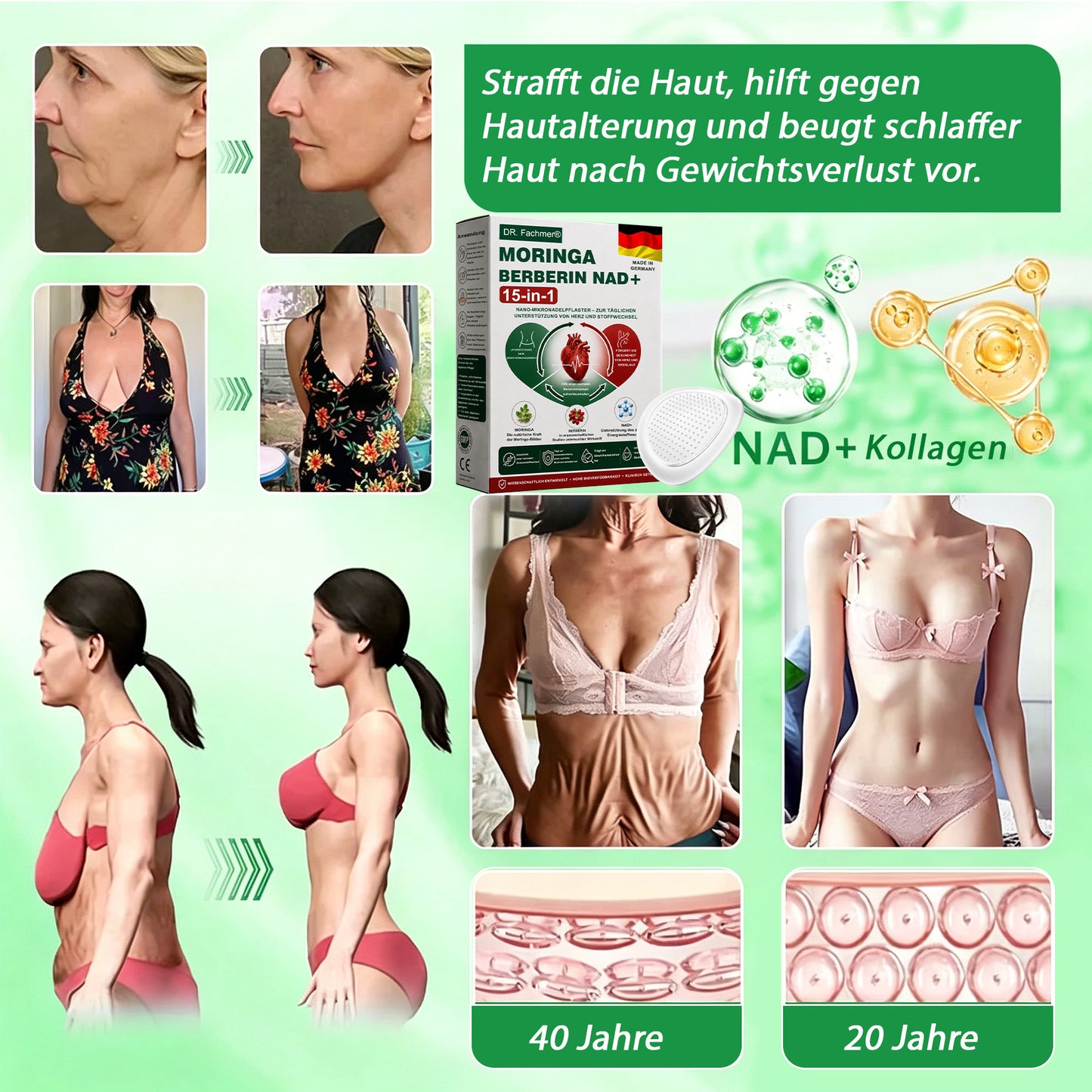 🇩🇪Offizieller Shop | 🏆 DR.Fachmer® Moringa Berberinex NAD+ 10-in-1 Nano-Mikronadel-Patch (Nur einmal täglich, sichtbare Veränderungen in 7 Tagen) ✅ Für Übergewicht, lockere Haut, Diabetes, Schlafapnoe, Gelenkprobleme und mehr