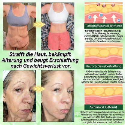 🇩🇪Offizieller Shop | 😉 GFOUK® Moringa Berberinex NAD+ 10-in-1 Nano-Mikronadel-Patch (Nur einmal täglich, sichtbare Veränderungen in 7 Tagen) ✅ Für Übergewicht, lockere Haut, Diabetes, Schlafapnoe, Gelenkprobleme und mehr