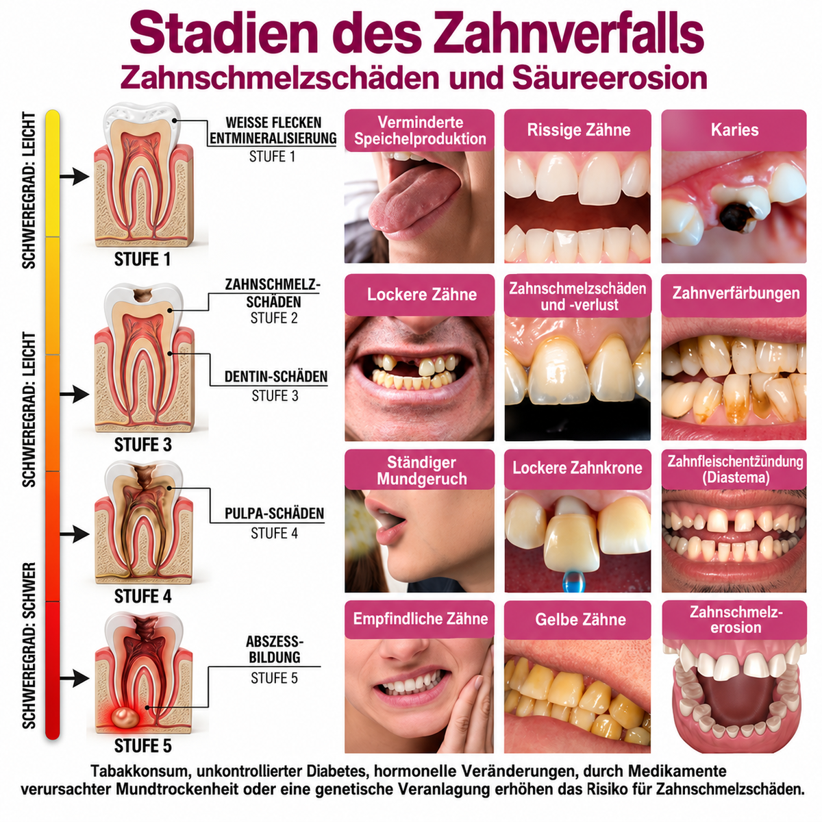 🤍 Rolimey® DenPerm – Natürliches Zahnschmelz-Füllgel zur Kariessanierung