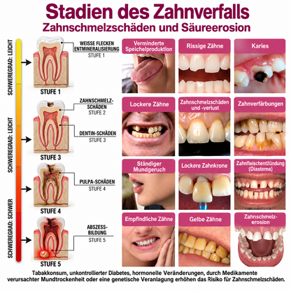🤍 Rolimey® DenPerm – Natürliches Zahnschmelz-Füllgel zur Kariessanierung